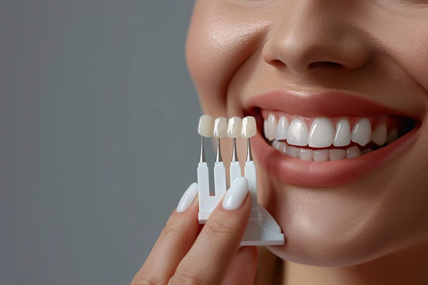 Pros And Cons Of Dental Veneers